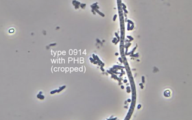 Bug of the Month: Filament Type 0914 and the Importance of Correct Diagnosis