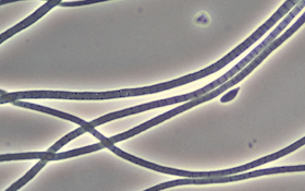 Bug of the Month: Sludge Bulking and Filament Type 021N