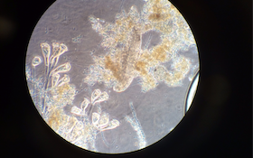 6 Photos of Creepy-Crawly Wastewater Microorganisms